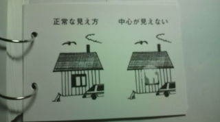 中心暗点のサンプル.jpg